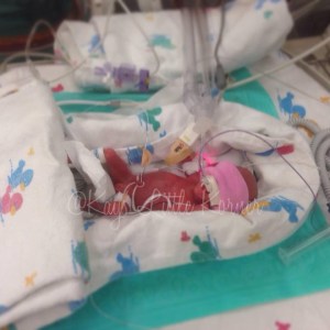 1379484_10203584611000578_1701078839_n